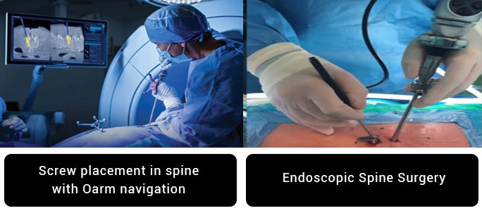 Understanding Minimally Invasive Brain and Spine Surgery - Appropriate Technology