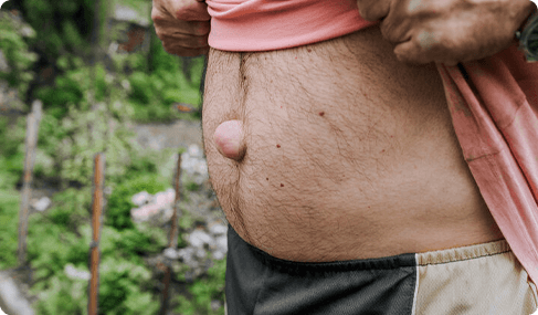 Symptoms of Hernia