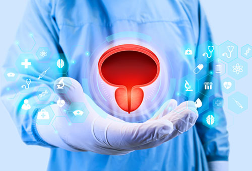 Prostate Specific Antigen (PSA)