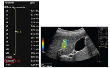Point Shear Wave Elastography (pSWE)