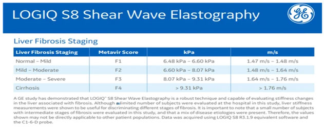2D Shear Wave Elastography