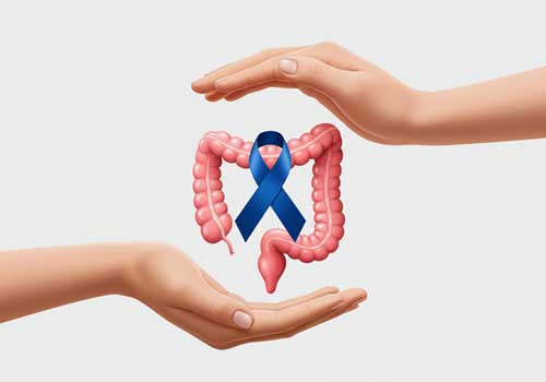 Colon Cancer